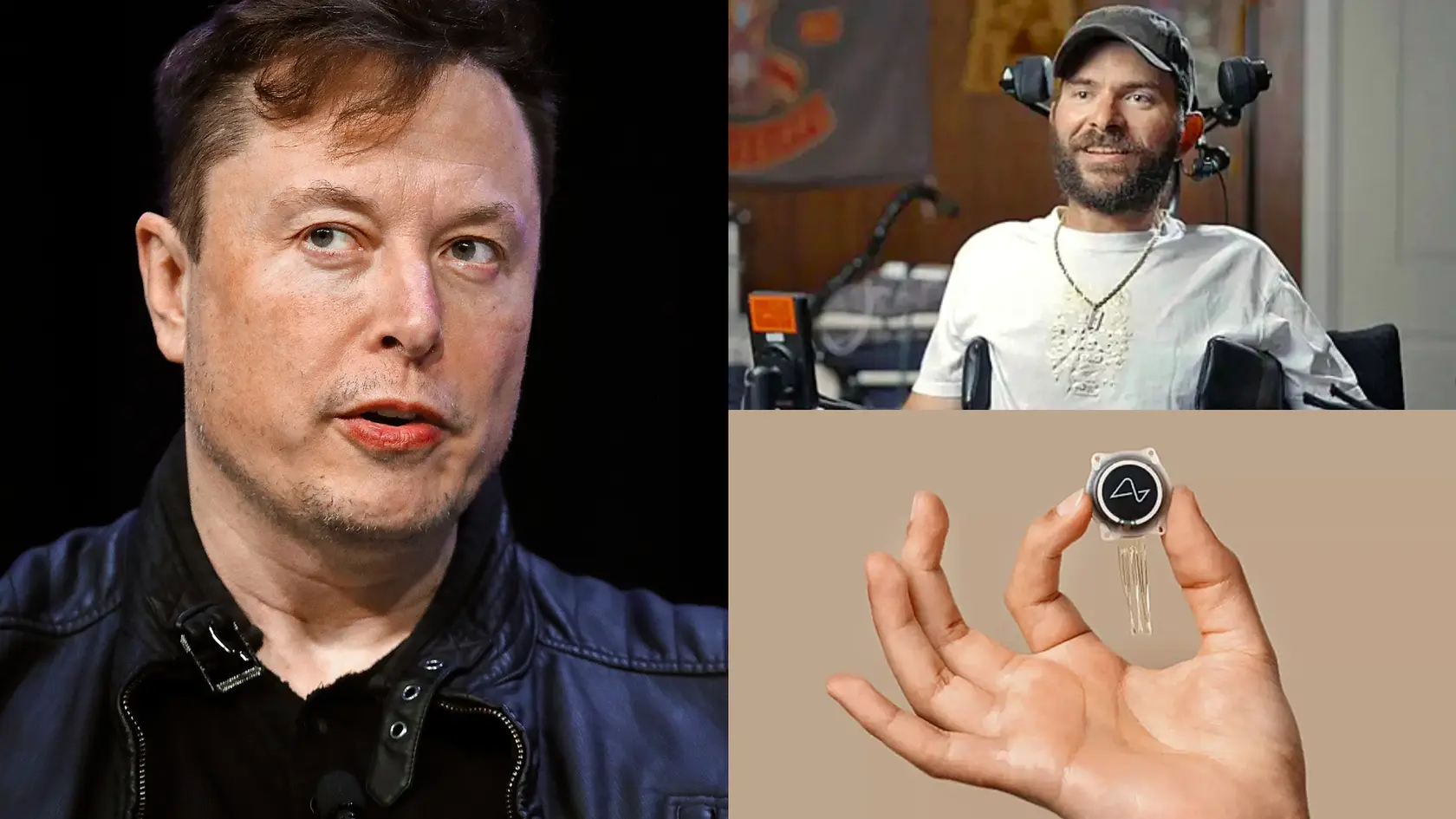 RJ dokáže vďaka čipu opäť vykonávať svoje obľúbené činnosti!