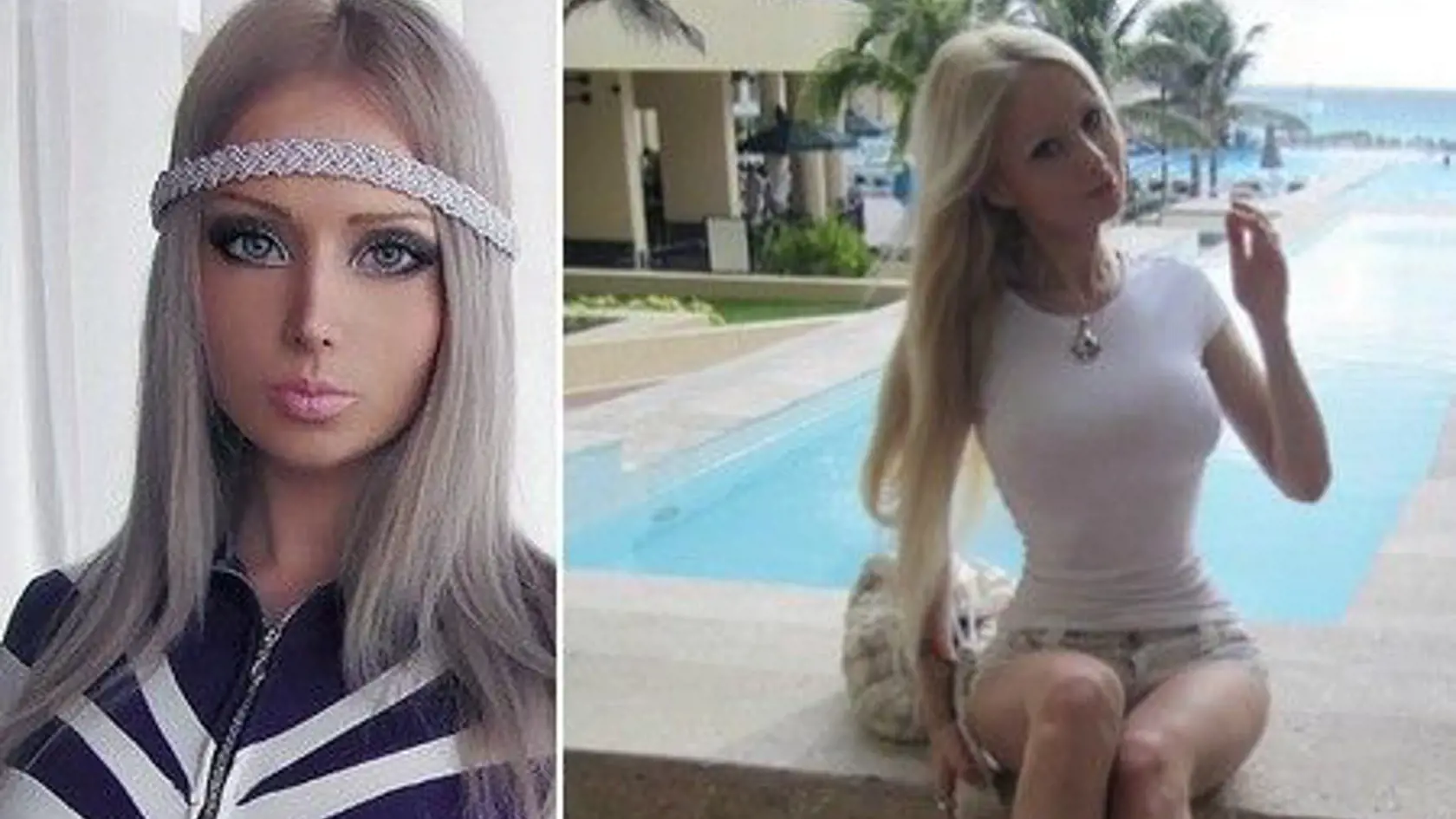 Ukrajinka Valéria sa na Barbie podobá tvárou,