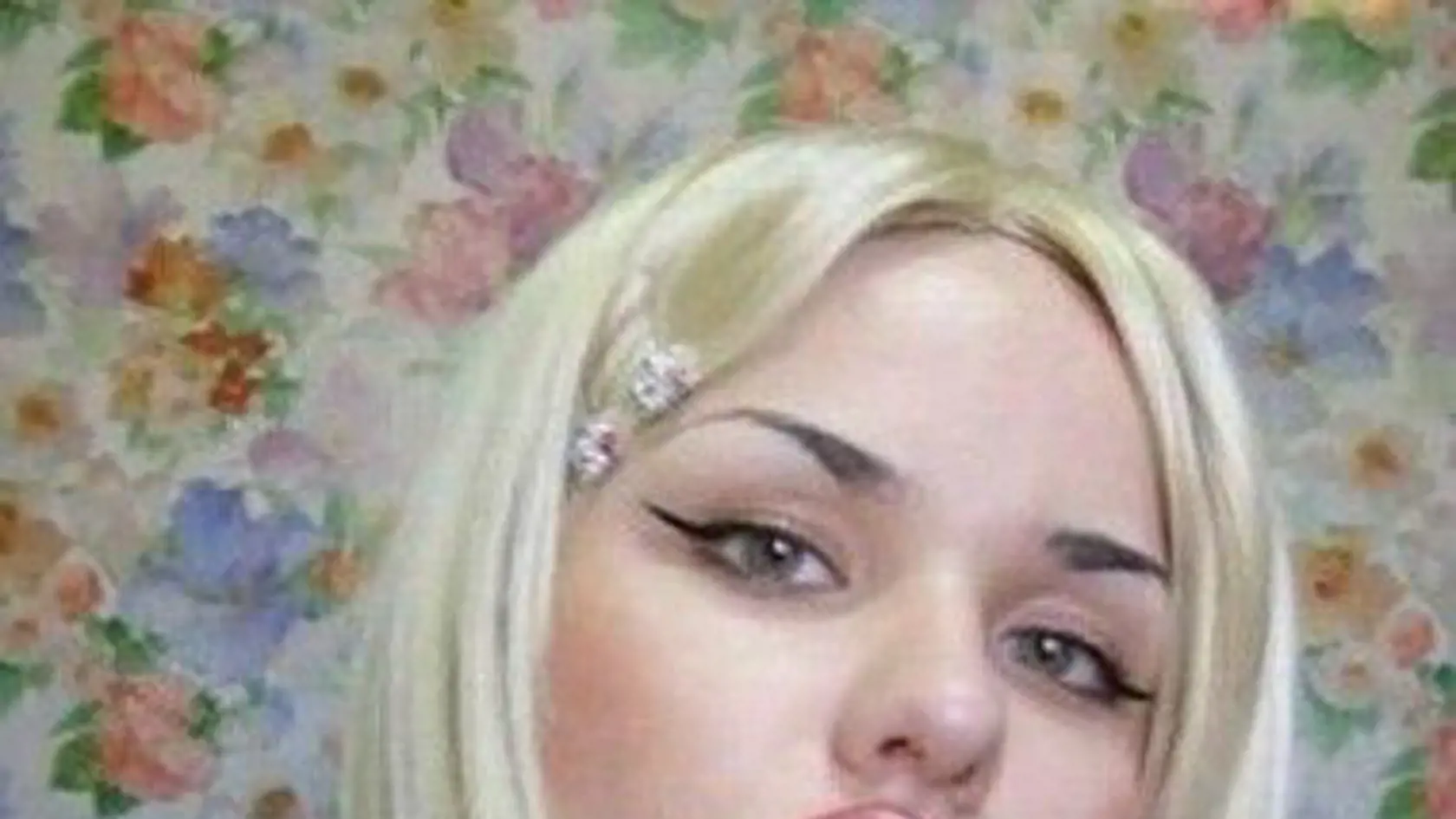 Čo spraví stovka výplňových injekcií do pier