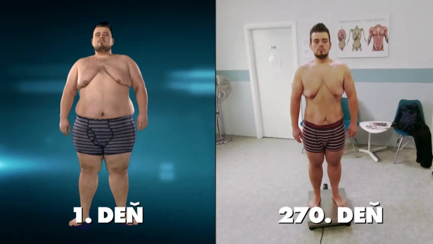 Miro schudol 56 kíl. A aj po natáčaní mal veľké plány: „Váhu si stále držím, ale naberám svalovú hmotu. Trikrát do týždňa cvičím crossfit a k tomu nejaké kardio. Do budúcnosti by som však chcel ísť s váhou ešte o pár kilogramov nižšie,“ prezradil Miro.