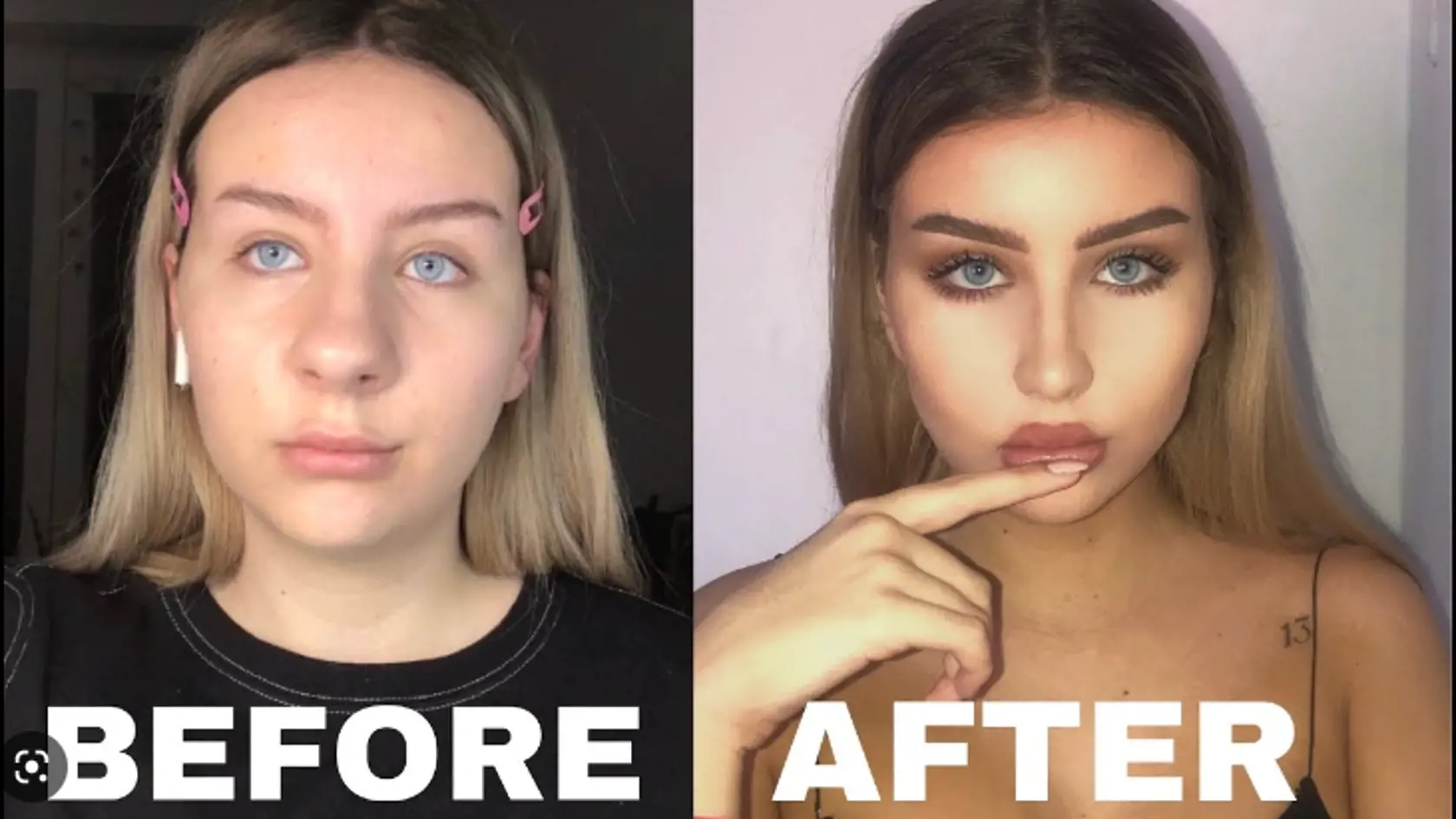 Spoznali by ste ju vôbec? Takto vyzerala Petrana pred plastikou.