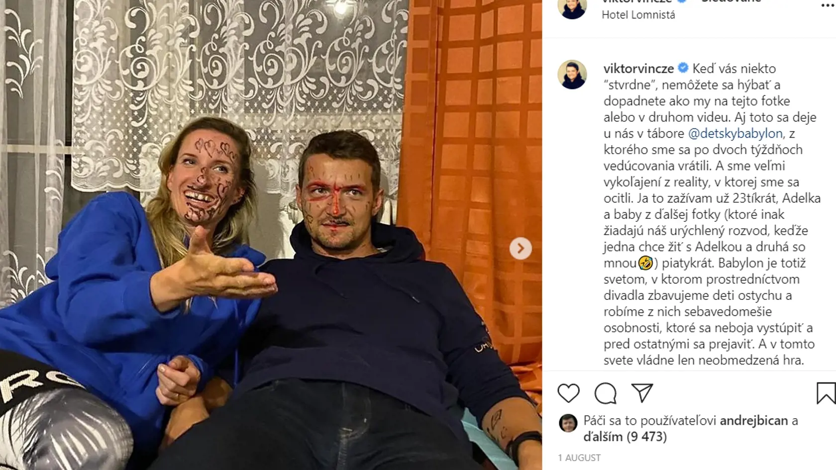 Adela objavila čaro sociálnych sietí a na fotografiách sa ukazuje aj v nie príliš lichotivých pózach.