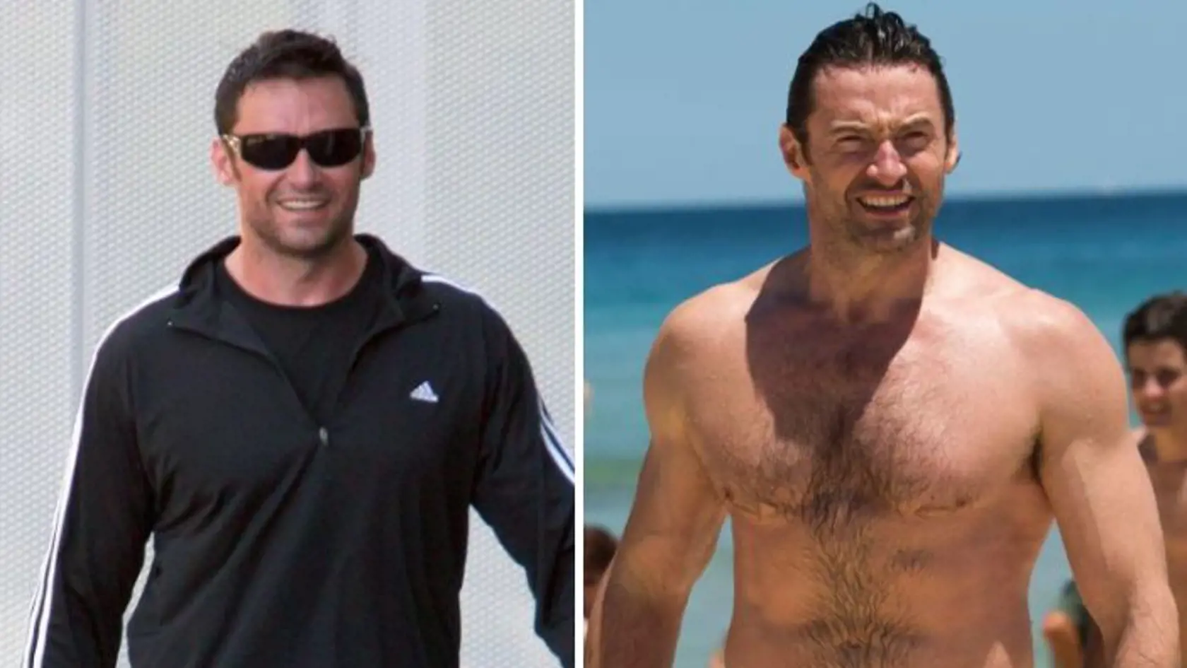 Hugh Jackman mal opäť rakovinu kože.
