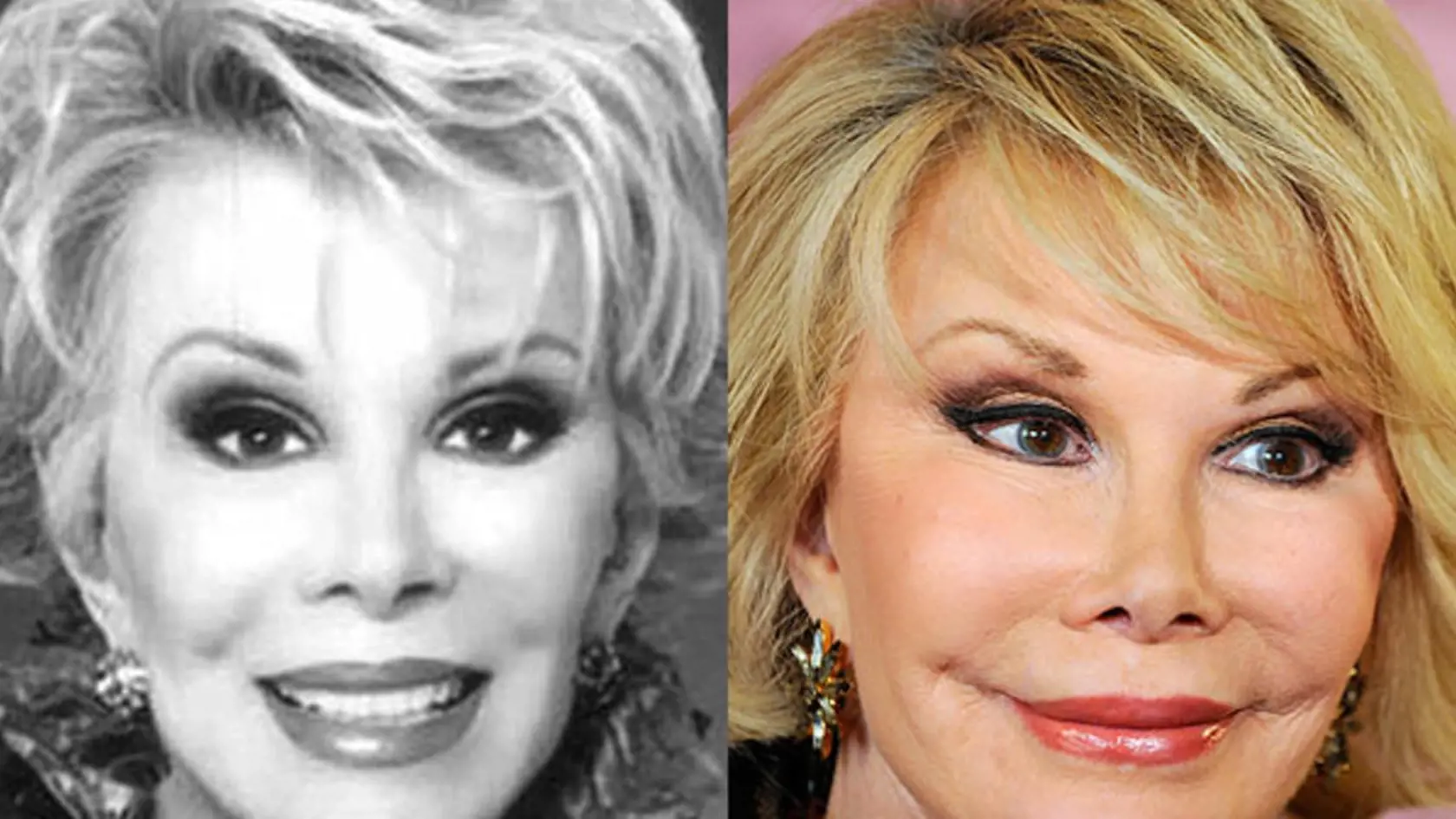 Joan Rivers