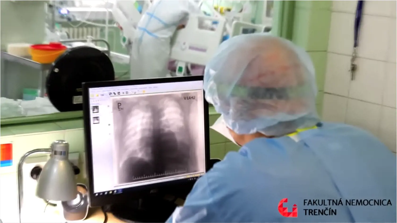 Nemocnica zverejnila video, v ktorom ukazuje, ako sa starajú o pacientov s COVID-19.