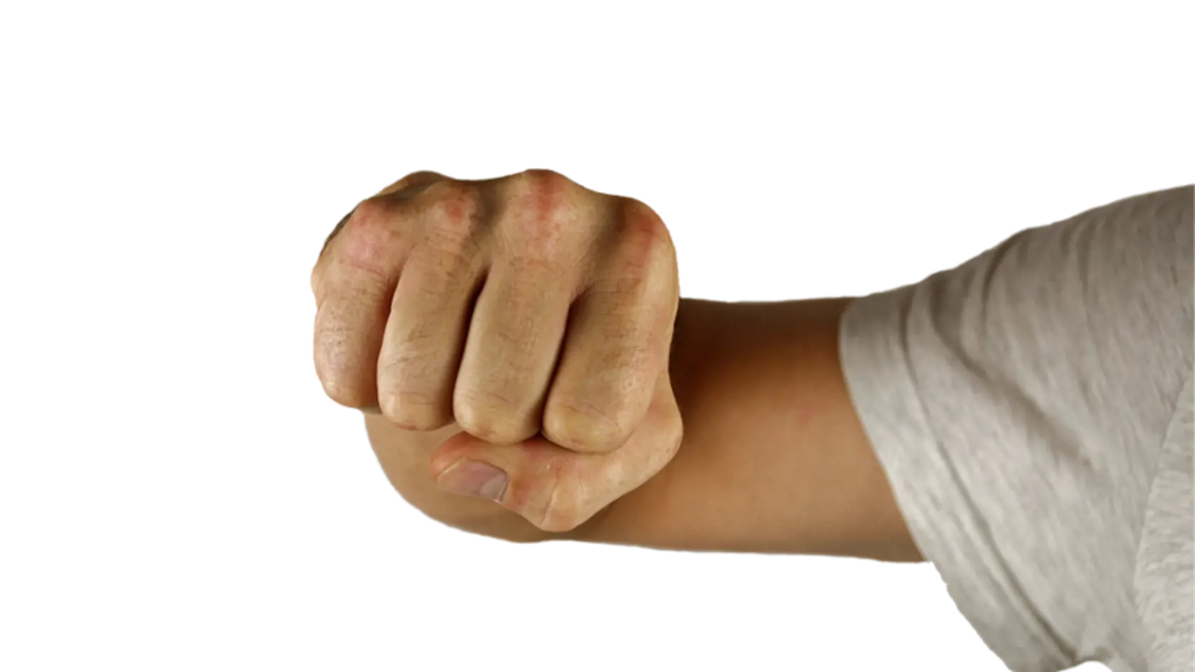 Po objatí dostala do tváre.