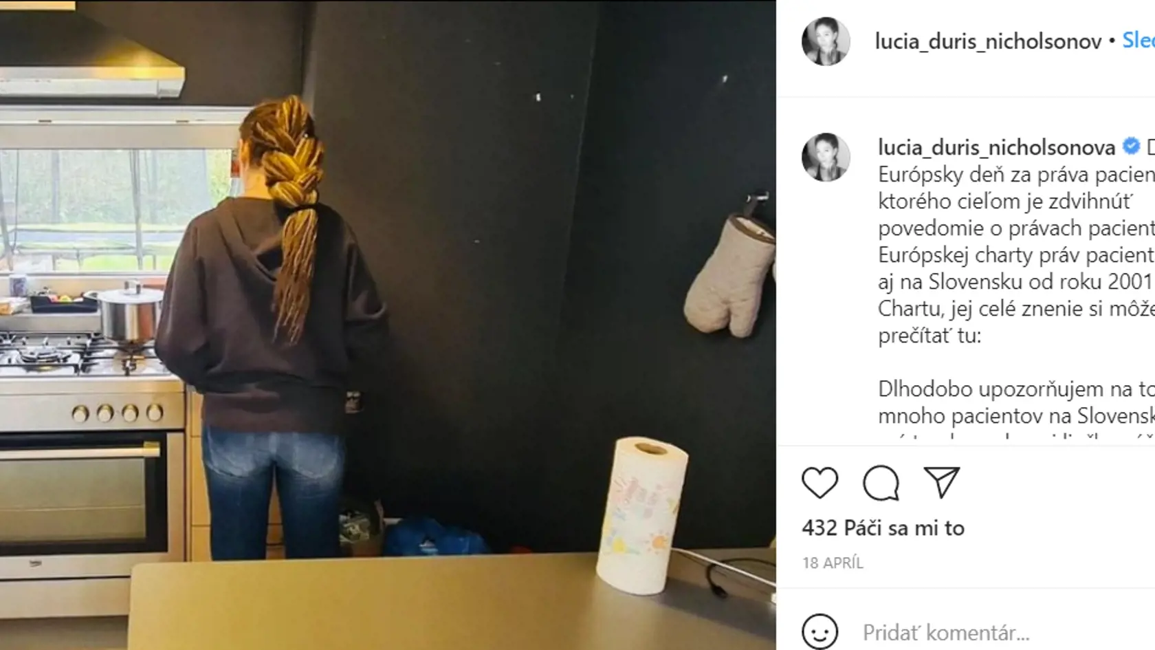 Mnohé známe tváre podľahli čaru dredov. Páčia sa vám?