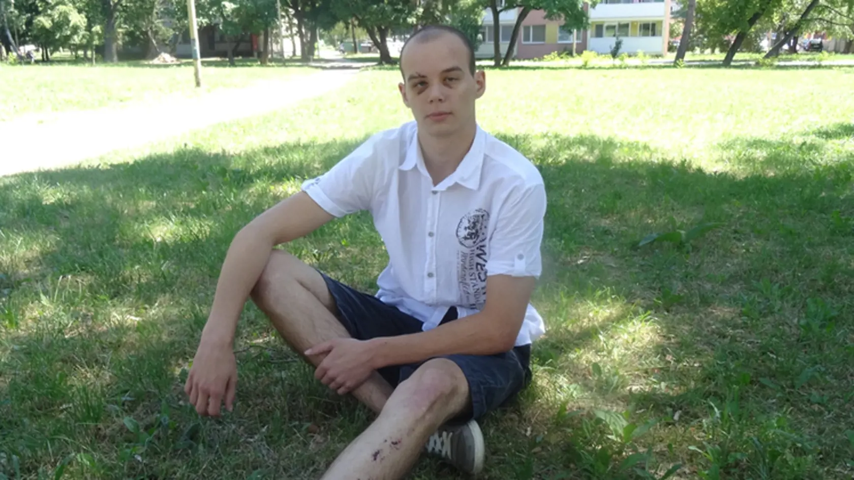 Dávida modriny na tvári a odreniny na nohách stále bolia.