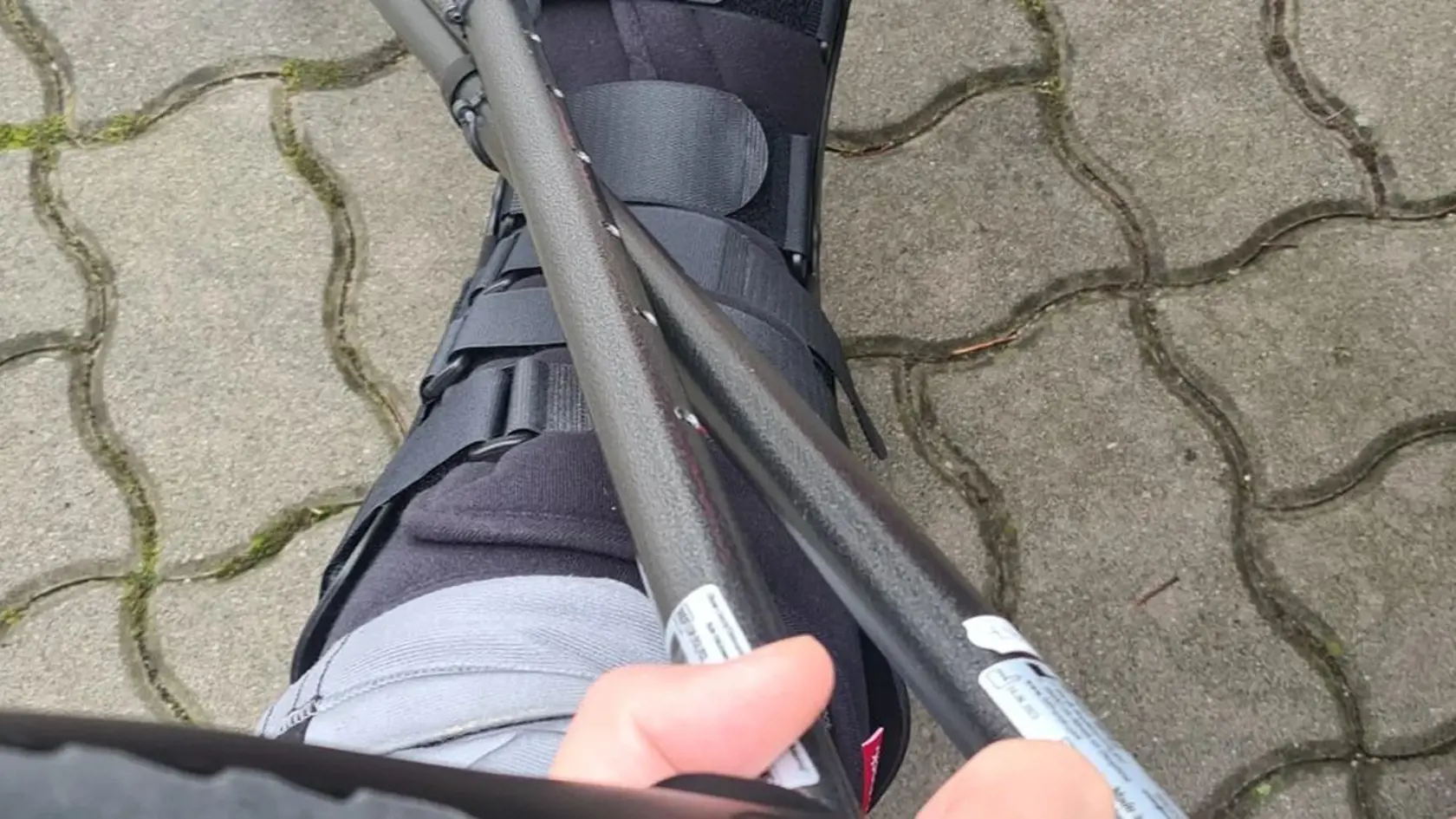 Jaro Slávik si zlomil kosť v nohe. To ho vyradilo z bežného života na deväť mesiacov.