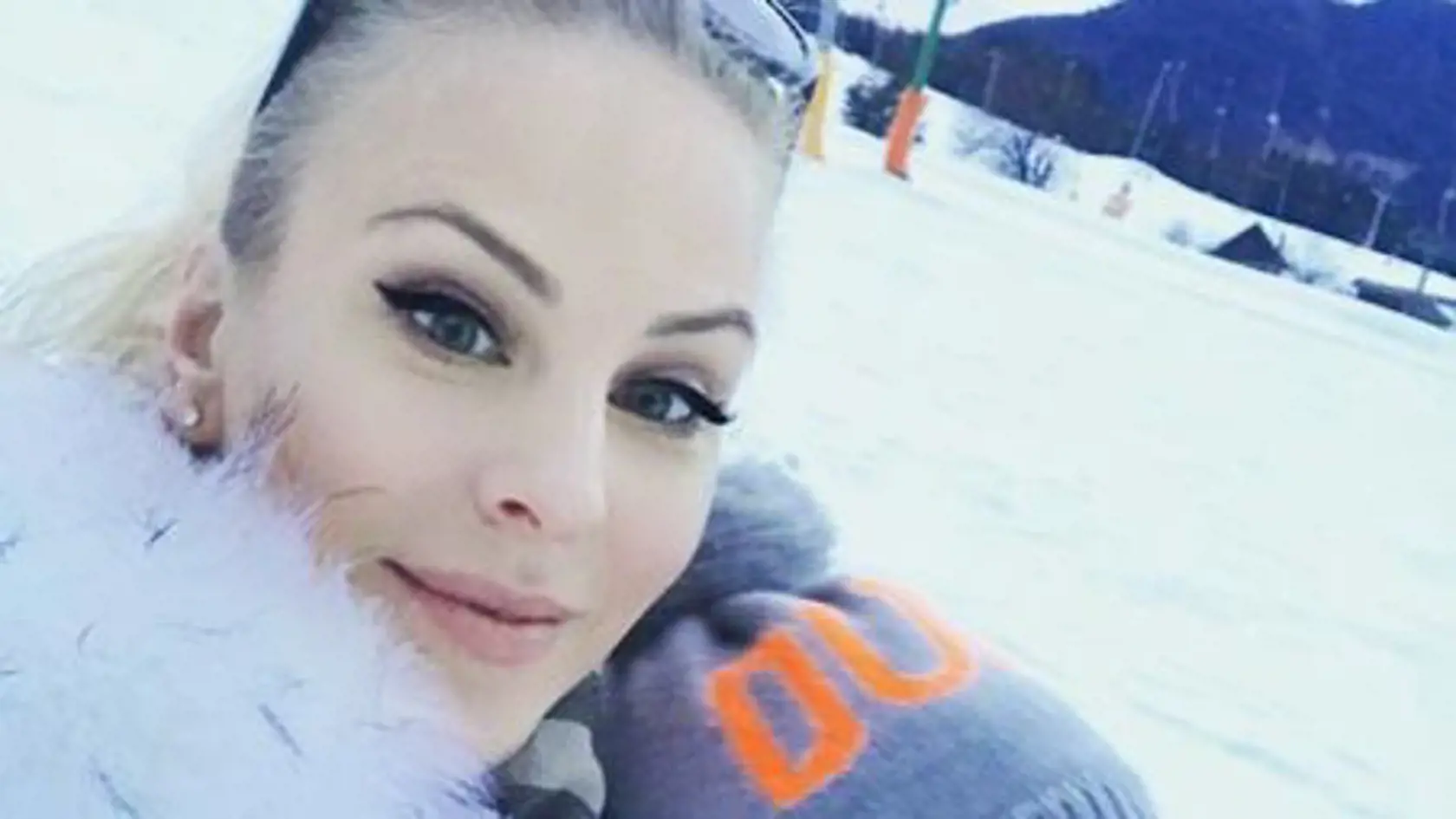 Už ani nevie hýbať tvárou! Barbora Balúchová vyzerá čoraz viac umelo: Toto jej máme uveriť? 
