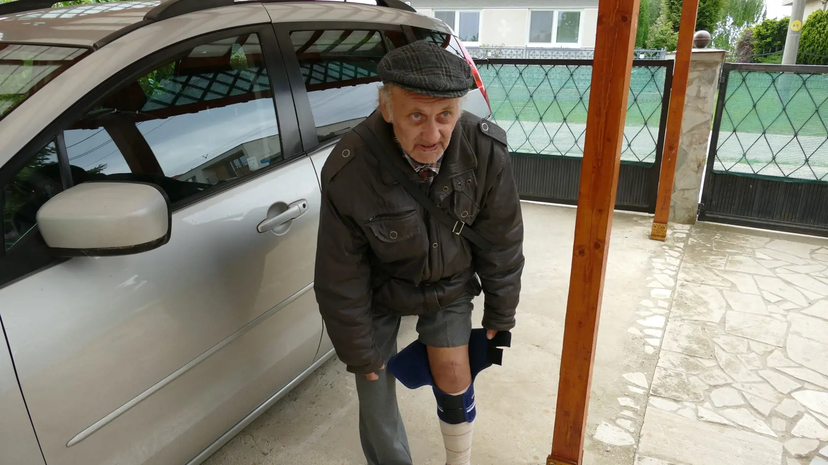 Karol Cigáň bol operovaný len pár dní pred tým, ako zbabrali operáciu Františkovi Rapanovi. Ani jeho operácie nedopadla dobre.