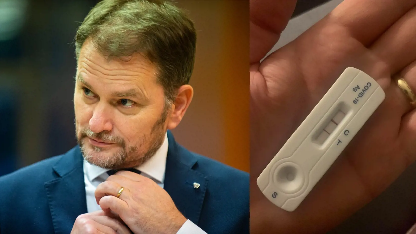 Igor Matovič má pozitívny test na koronavírus.