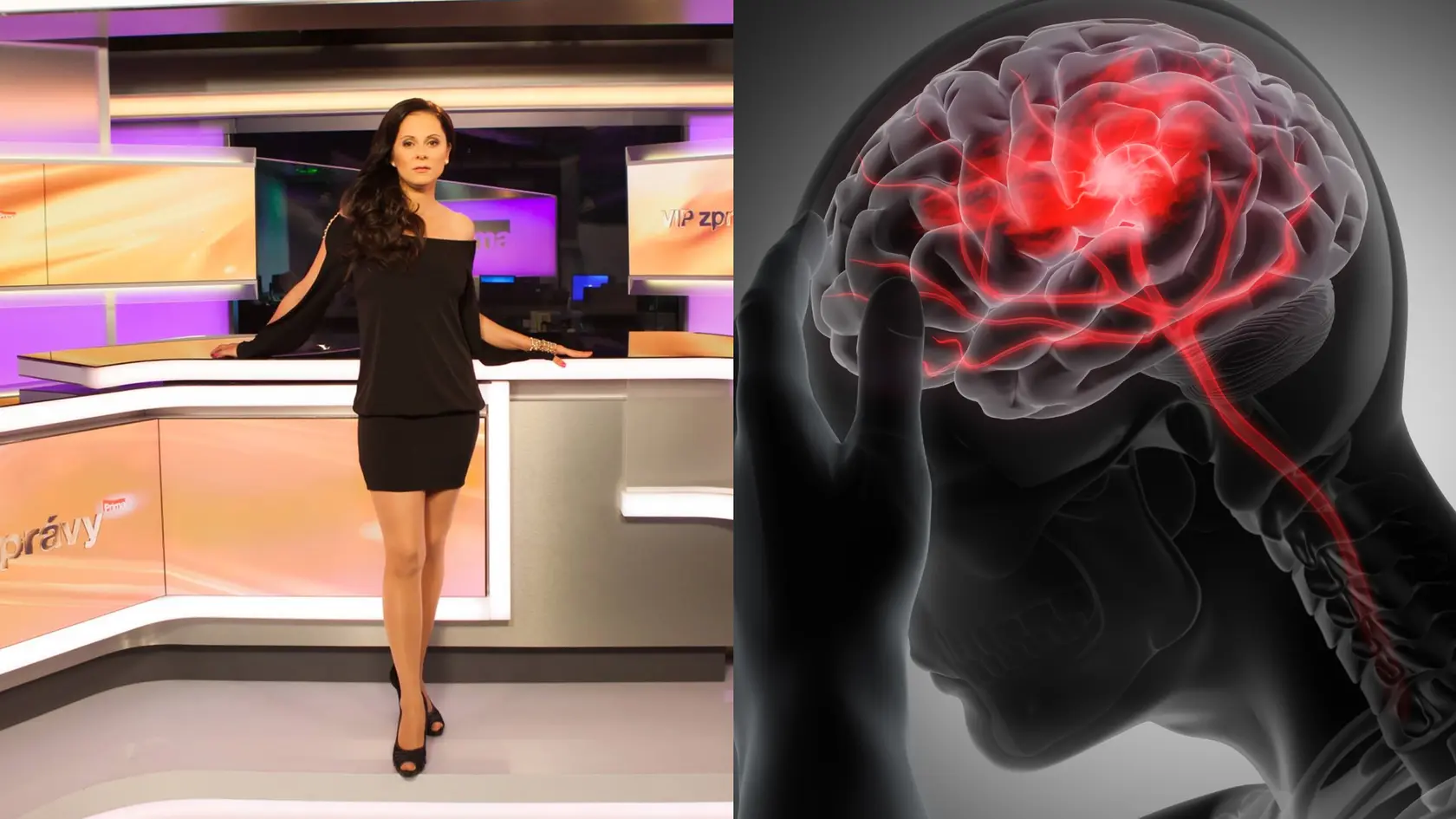 Aké sú príznaky rakoviny mozgu, ktorú diagnostikovali Laďke Něrgešovej?