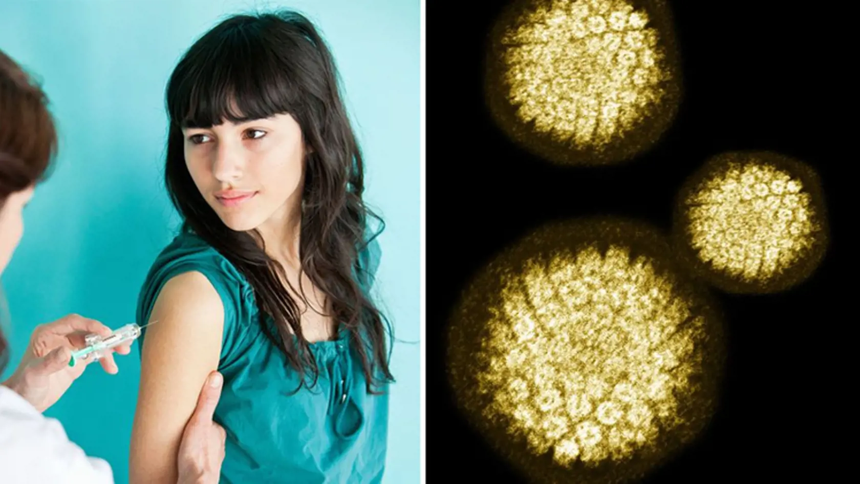 Slovenky sa môžu proti rakovine krčka maternice lepšie chrániť – ale musia ísť do Česka! Takto vyzerá zákerný HPV vírus. (vpravo)
