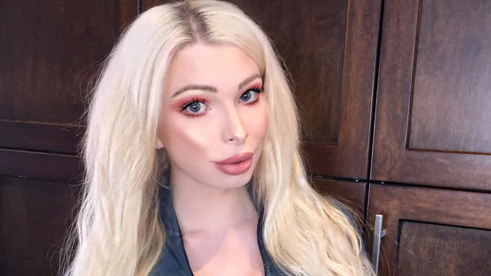 Má iba 23 rokov a množstvo plastických operácií: Chcela byť ako Marilyn Monroe, no je ako...Fú!