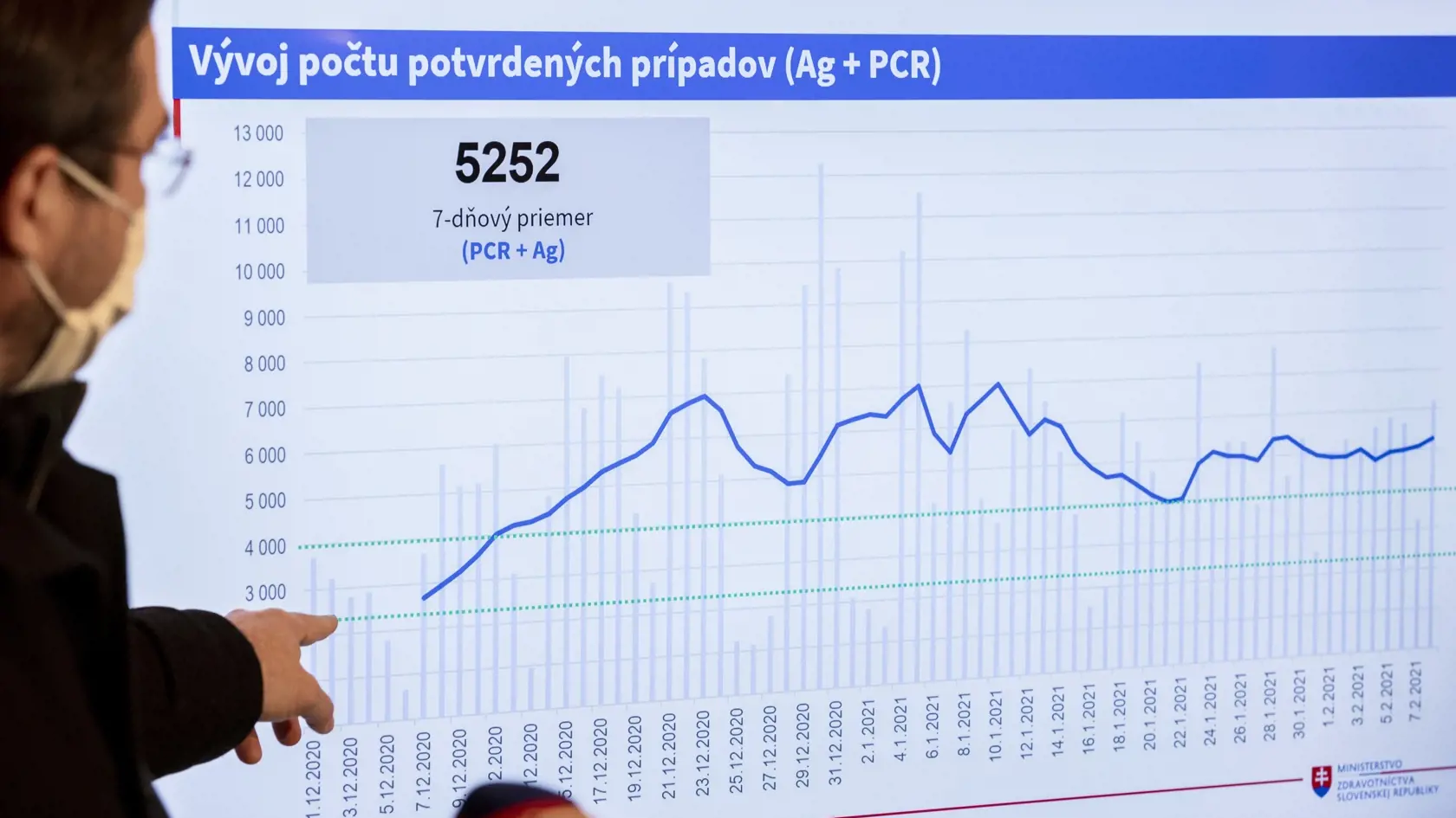 Na snímke minister zdravotníctva SR Marek Krajčí (OĽaNO) počas tlačovej konferencie k aktuálnej epidemiologickej situácii v Bratislave 9. februára 2021. FOTO TASR - Jaroslav Novák
