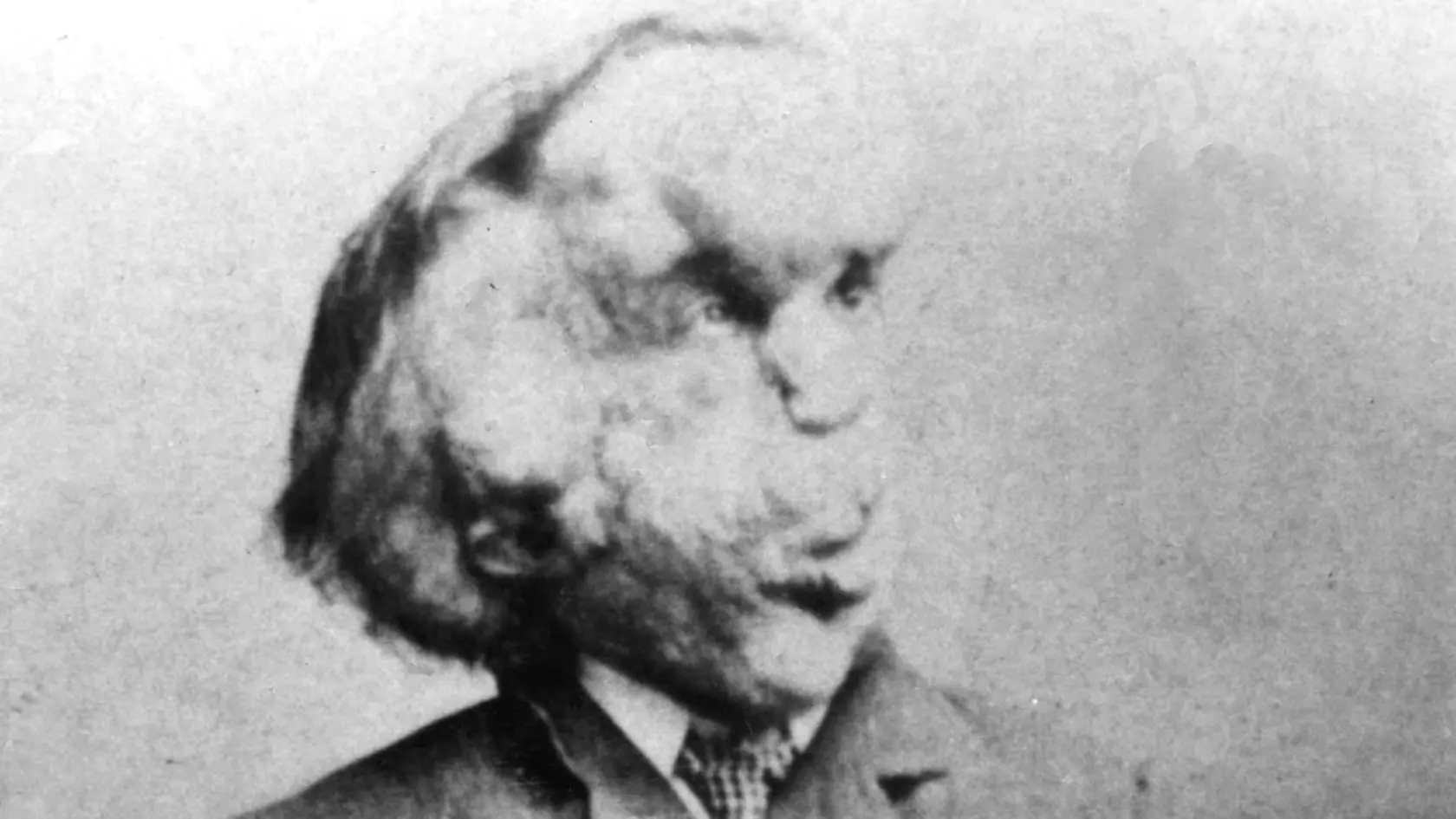 JOSEPH MERRICK bol inteligentný, sčítaný a citovo založený mladík, nie mentálne retardovaný, ako si o ňom mnohí mysleli.