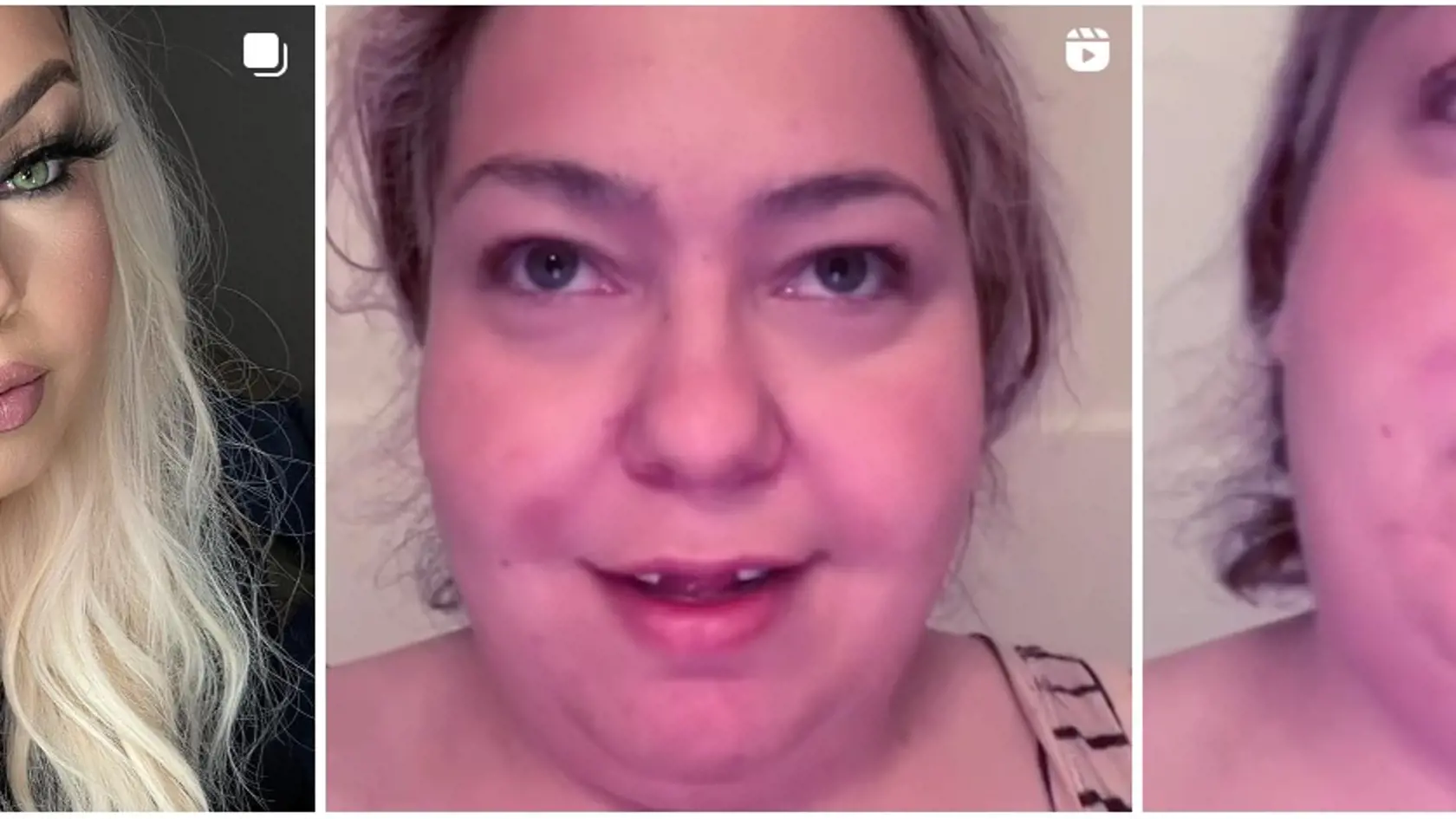 Sarah pre svoj vzhľad neraz stretla so šikanou, ktorá jej veľmi ubližovala. Dnes svoju tvár ukazuje celému svetu a fandí jej mnoho ľudí.