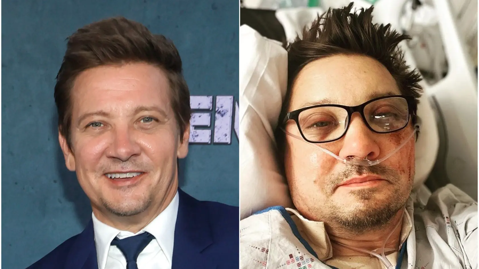 Jeremy utrpel veľmi vážnu nehodu.