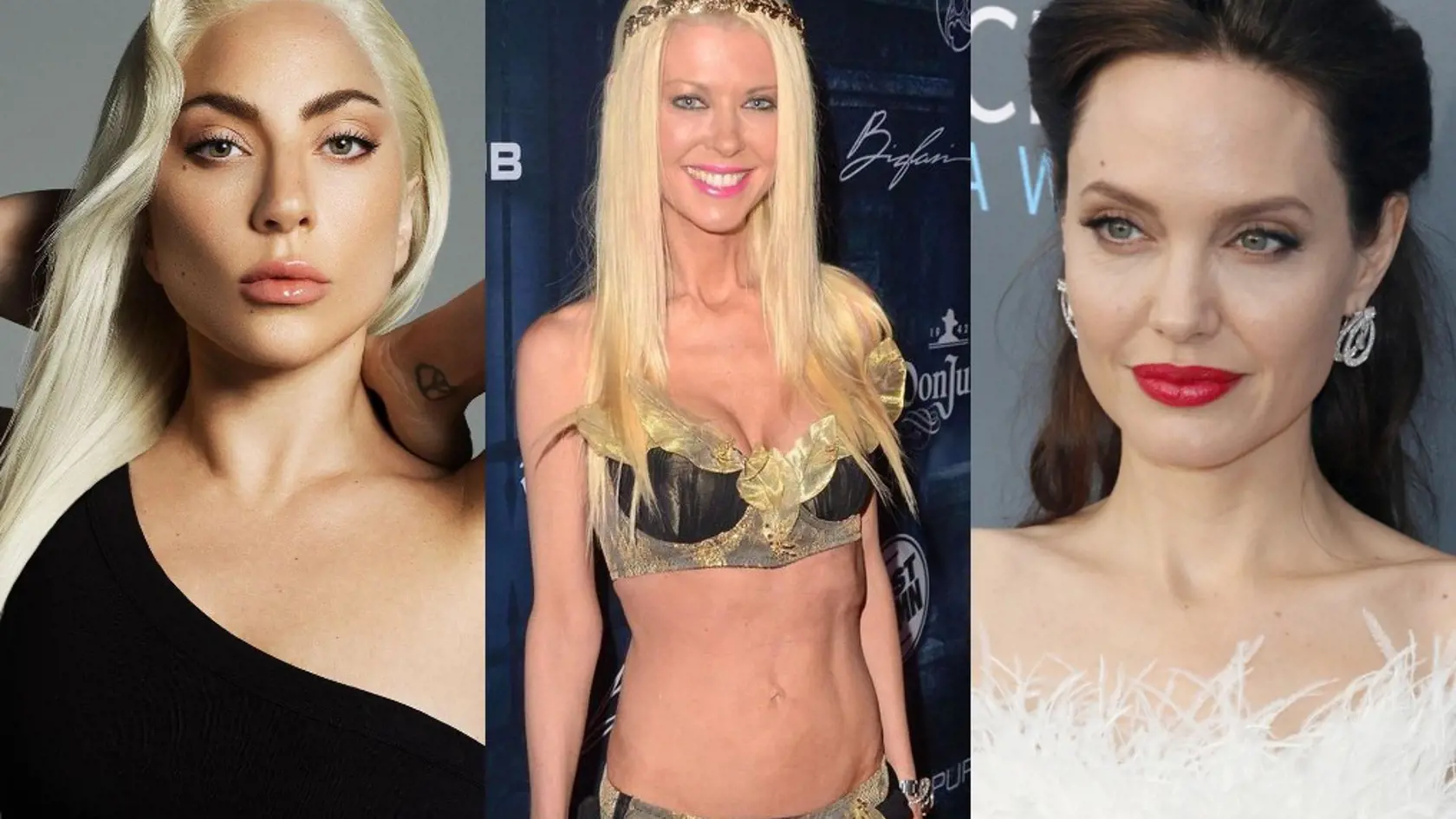 Celebrity anorexia