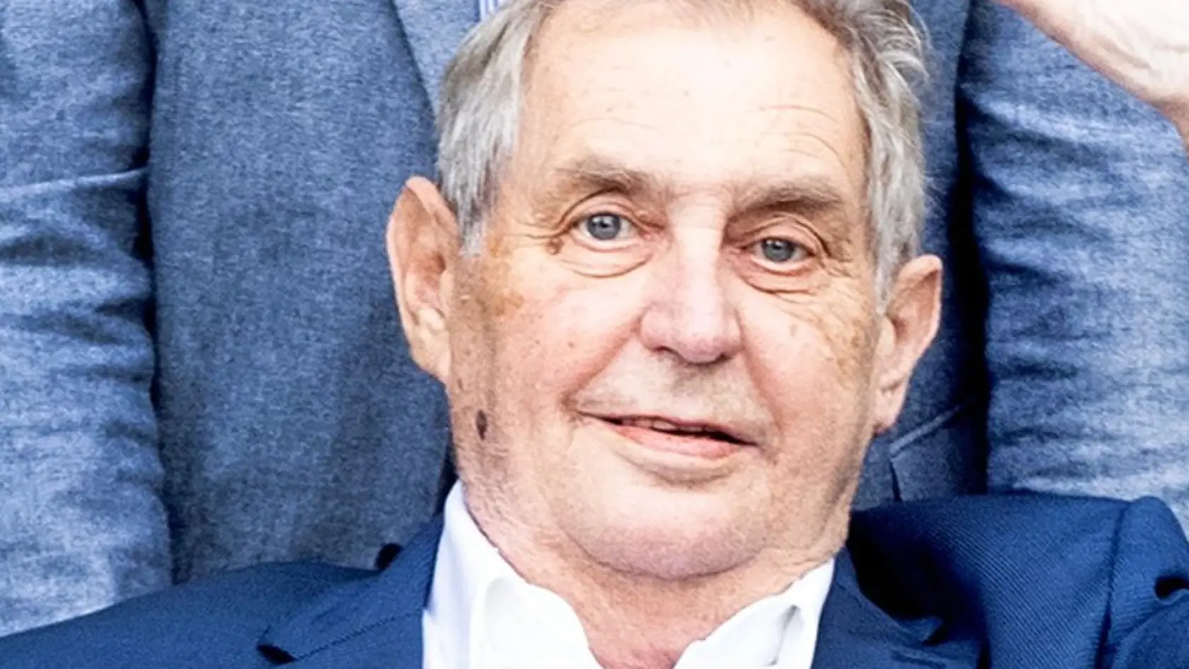 Prezident ČR Miloš Zeman má do žalúdka zavedenú vyživovaciu sondu (PEG) a v nemocnici bude ešte najmenej tri týždne.