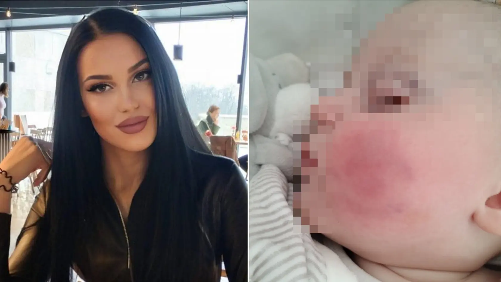 Bianca hľadá mamičku chlapca, ktorý podľa nej pohrýzol jej synčeka.