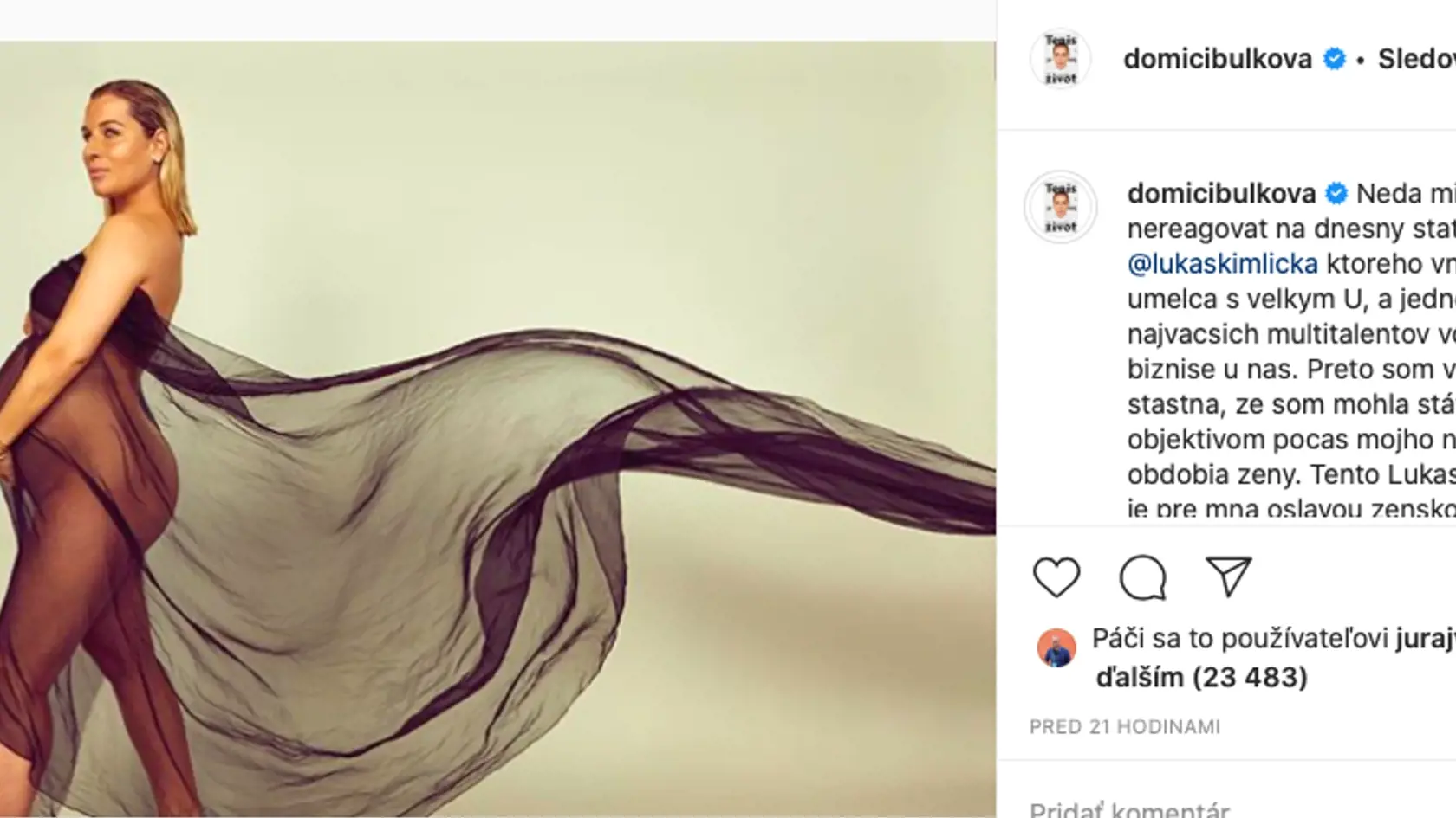 Dominika sa nechala nafotiť pre známy módny časopis a vznikli z toho tieto šteklivé fotografie.