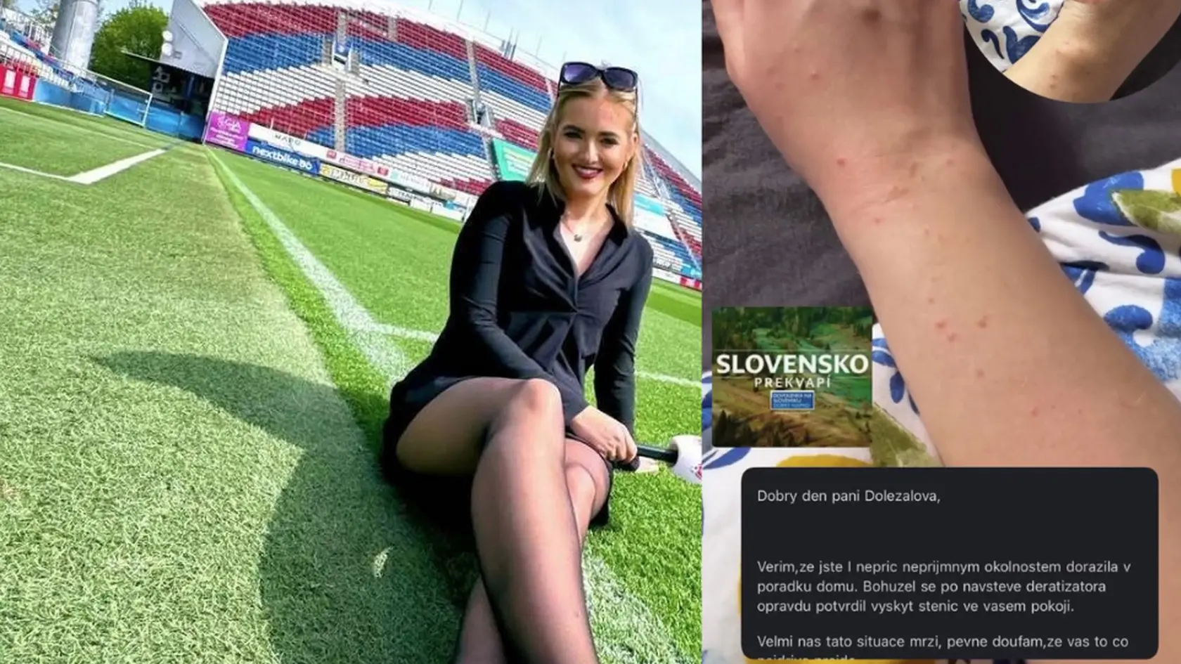 PR manažérka českej futbalovej asociácie si z ME na Slovensku priviezla domov nepríjemný zážitok.