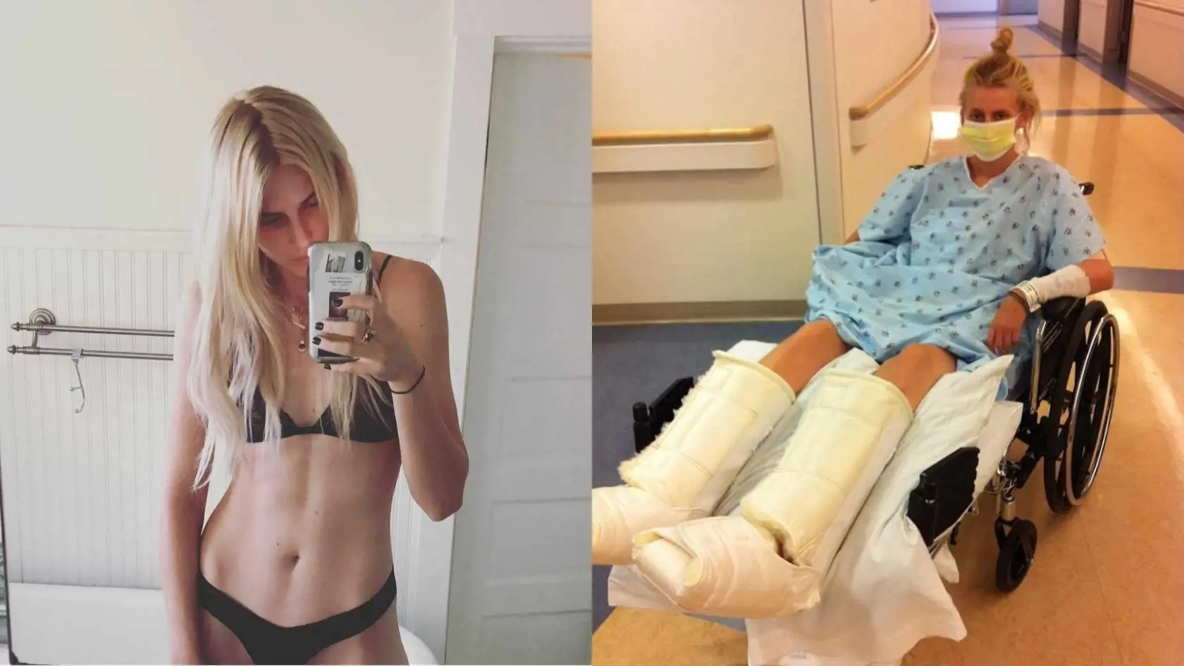 Mala pred sebou sľubnú budúcnosť v módnom priemysle a rozbehnutú úspešnú kariéru. O niekoľko hodín sa krásnej Lauren (35) však život obrátil o 180 stupňov, kvôli jednému tampónu prišla o obe nohy a takmer o život!
