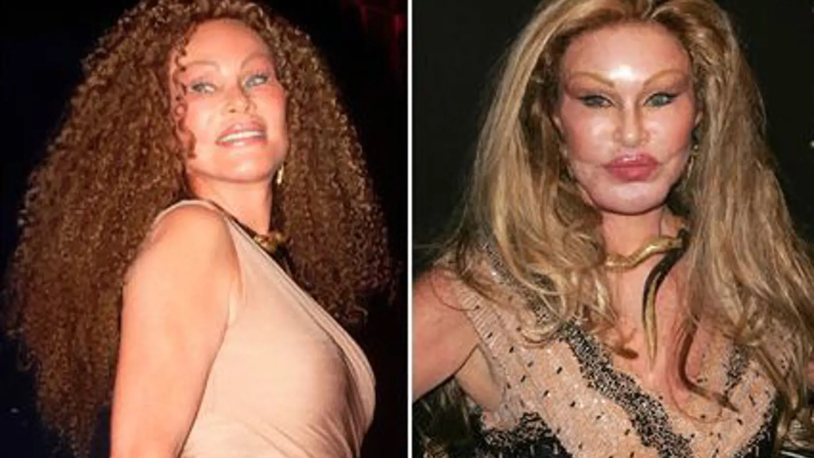 Jocelyn Wildenstein