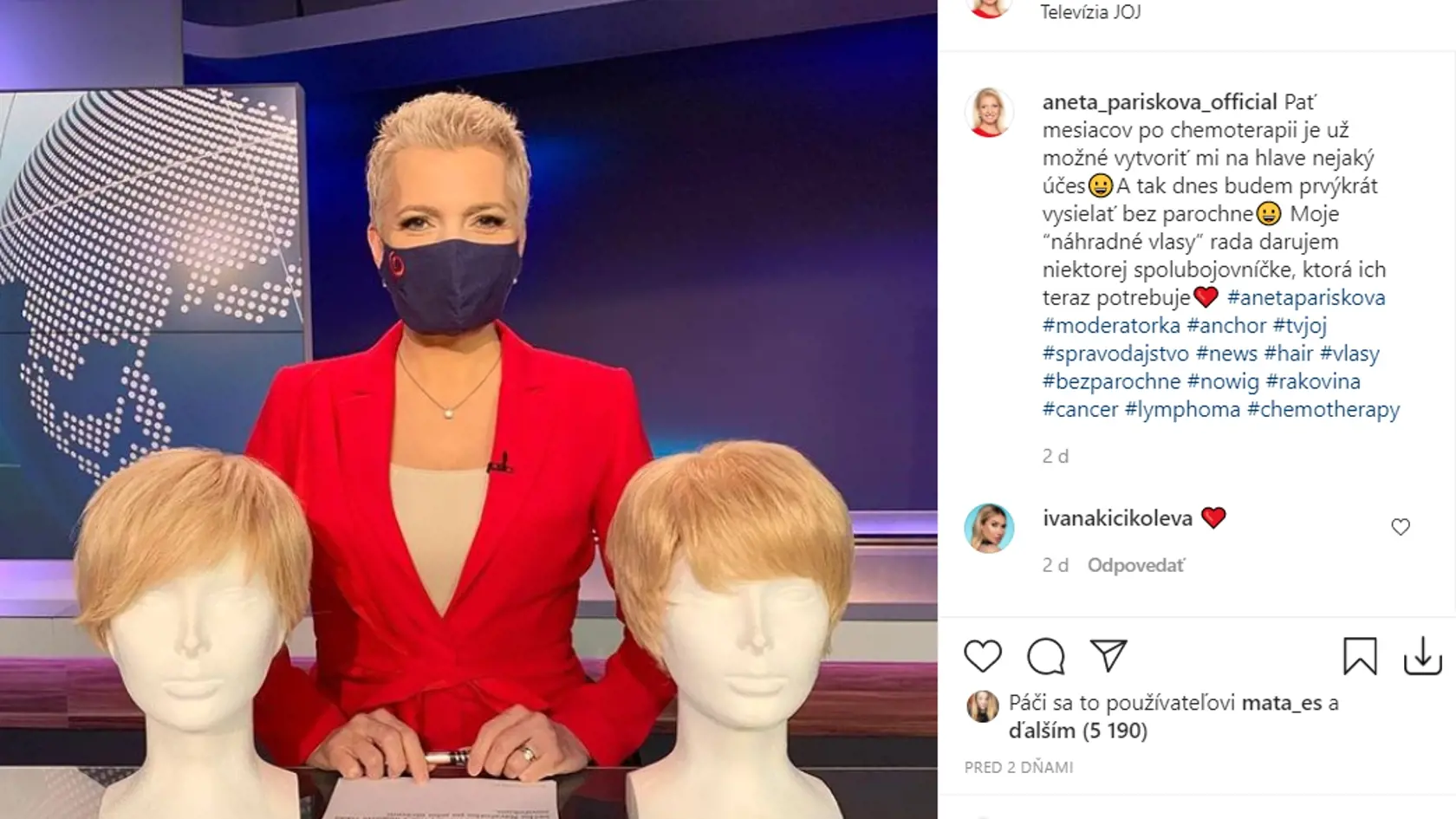 Aneta Parišková sa po piatich mesiacoch chcemoterapie postavila pred kamerami so svojimi vlasmi.
