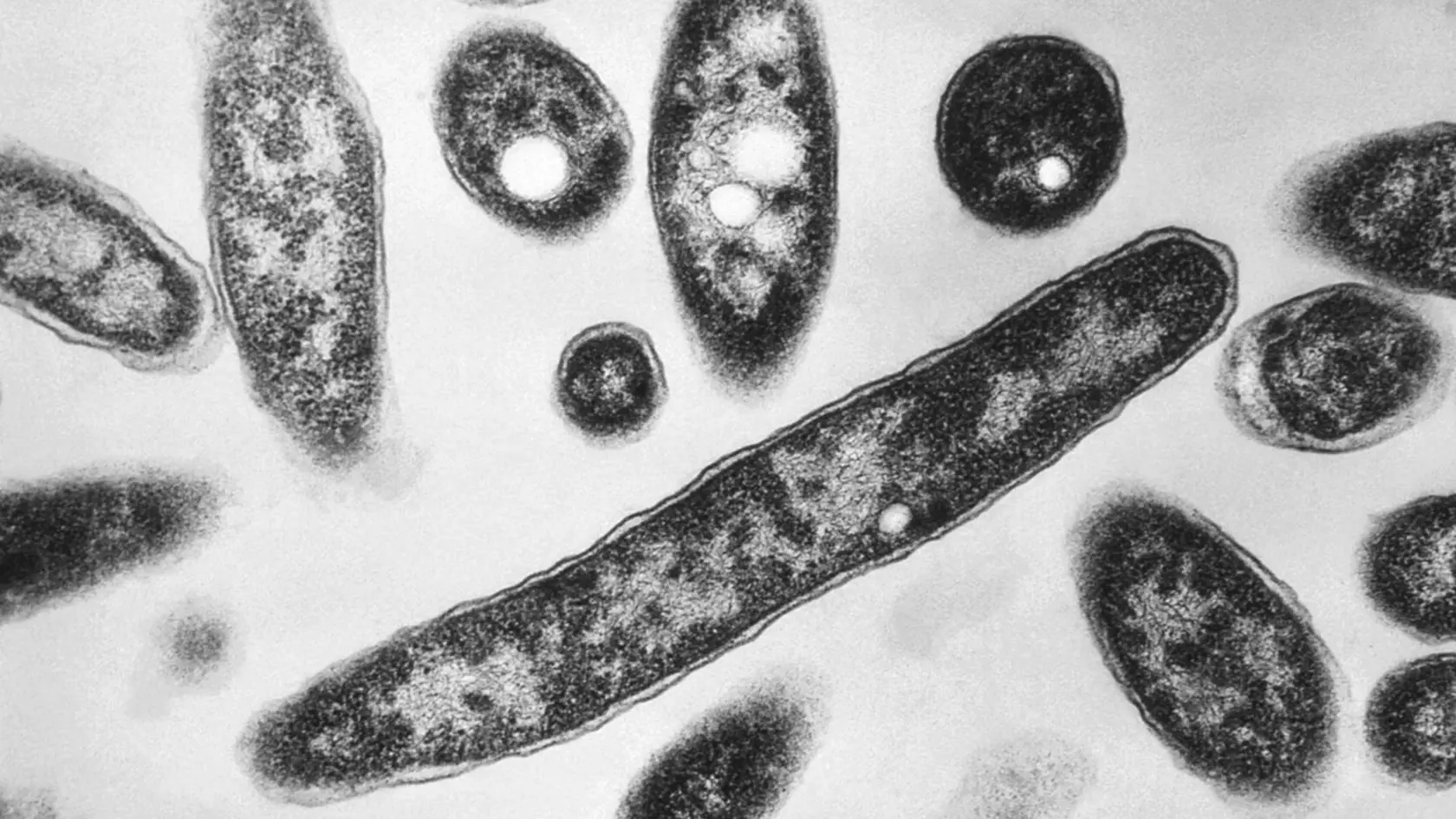 Snímka z elektrónového mikroskopu z roku 1978, ktorý sprístupnili Centrá pre kontrolu a prevenciu chorôb, ukazuje baktérie Legionella pneumophila, ktoré sú zodpovedné za spôsobenie pľúcneho ochorenia legionárska choroba.