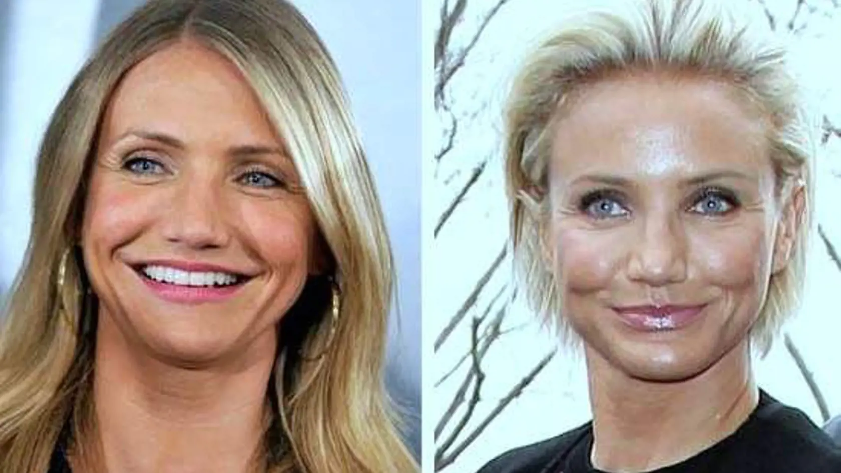 Cameron Diaz vyskúšala botox iba raz, no trpko to oľutovala. "Radšej uvidím moju tvár prirodzene starnúť, už to nikdy nespravím," povedala herečka.