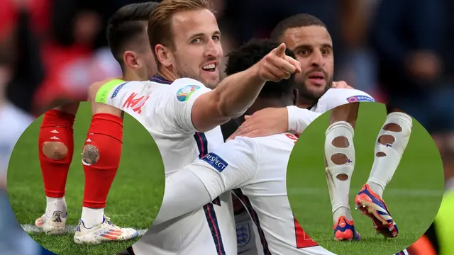 Ak ste si mysleli, že deravé štucne futbalistov sú len módny výstrelok alebo znak šetrenia, mýlite sa.